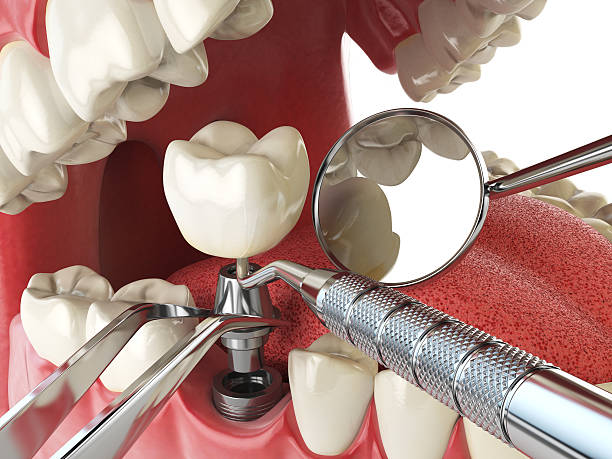Best Tooth Infection Emergency Dentist  in Wenona, IL